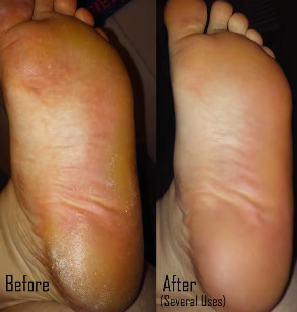 SilkySole™ Electric Foot File