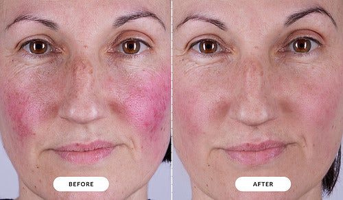 Premium Rejuvenation Mask™