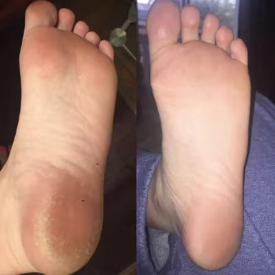 SilkySole™ Electric Foot File