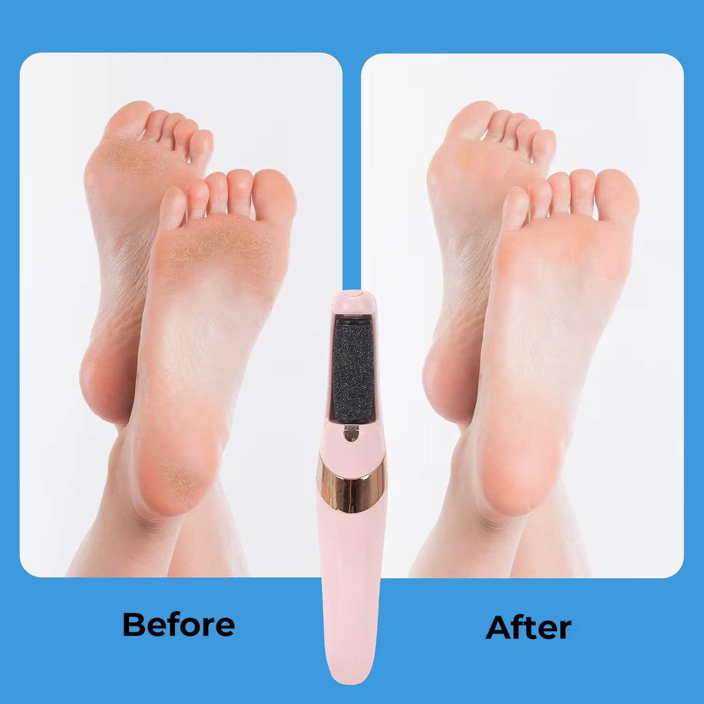 SilkySole™ Electric Foot File