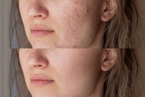 Premium Rejuvenation Mask™