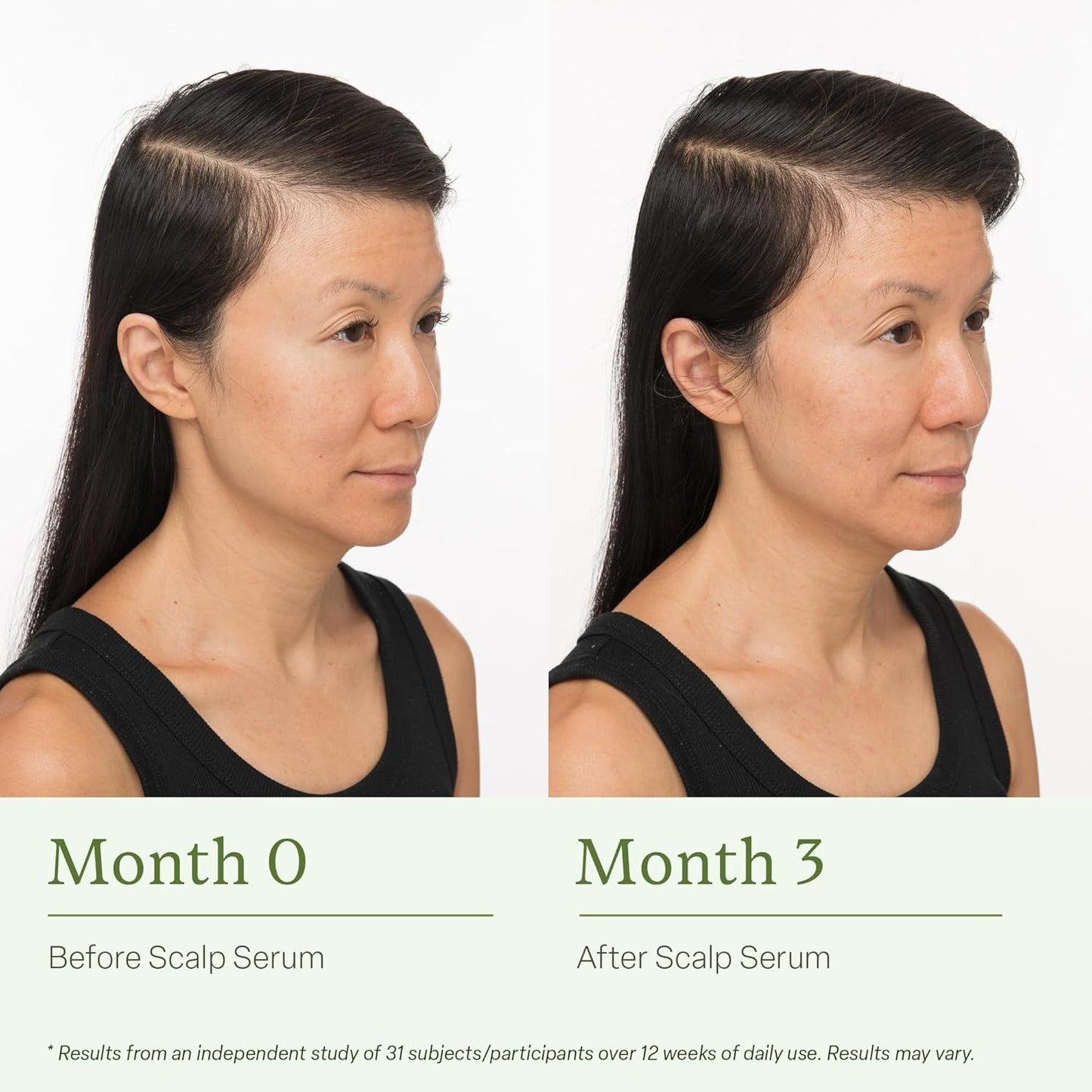 divi Scalp Serum for Thinning Hair, 30ml – Clinically Tested, Nourishing Formula with Amino Acids, Caffeine & Rosemary Oil – Promotes Healthy Scalp & Fuller-Looking Hair, Reduces Oil & Product Buildup