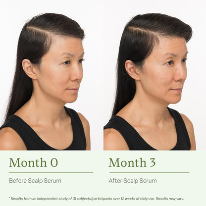 divi Scalp Serum for Thinning Hair, 30ml – Clinically Tested, Nourishing Formula with Amino Acids, Caffeine & Rosemary Oil – Promotes Healthy Scalp & Fuller-Looking Hair, Reduces Oil & Product Buildup